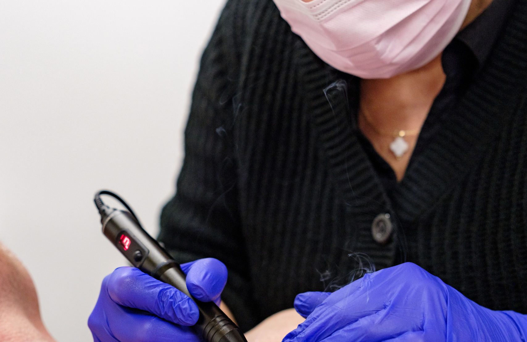 Blemish Removal: Achieve Clear, Flawless Skin