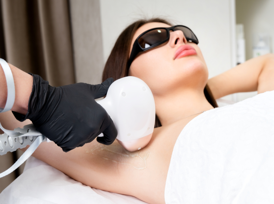 Laser Hair removal