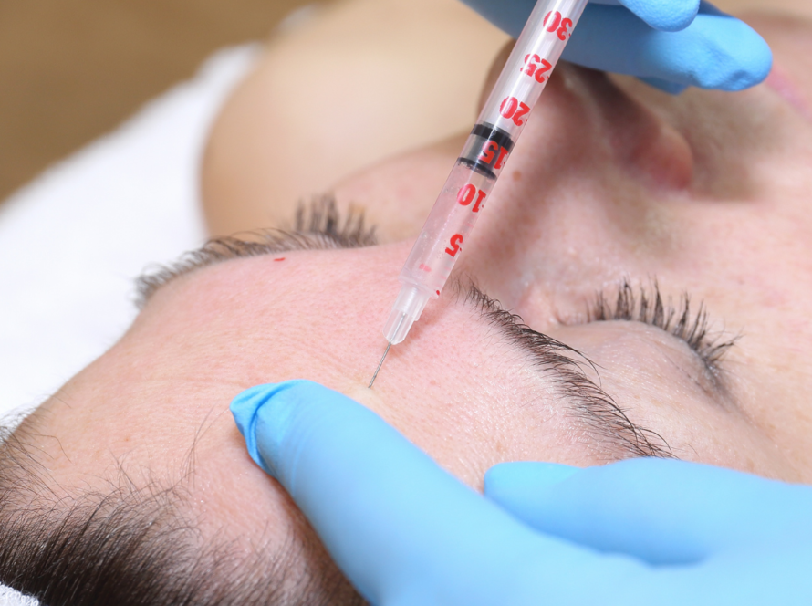 Antiu wrinkle Injections - Botox