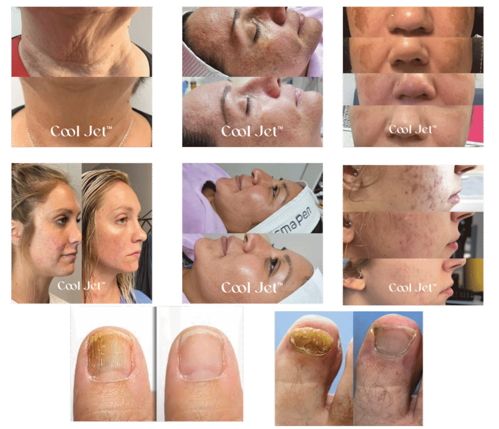 Before and after for skin conditions and nail fungus