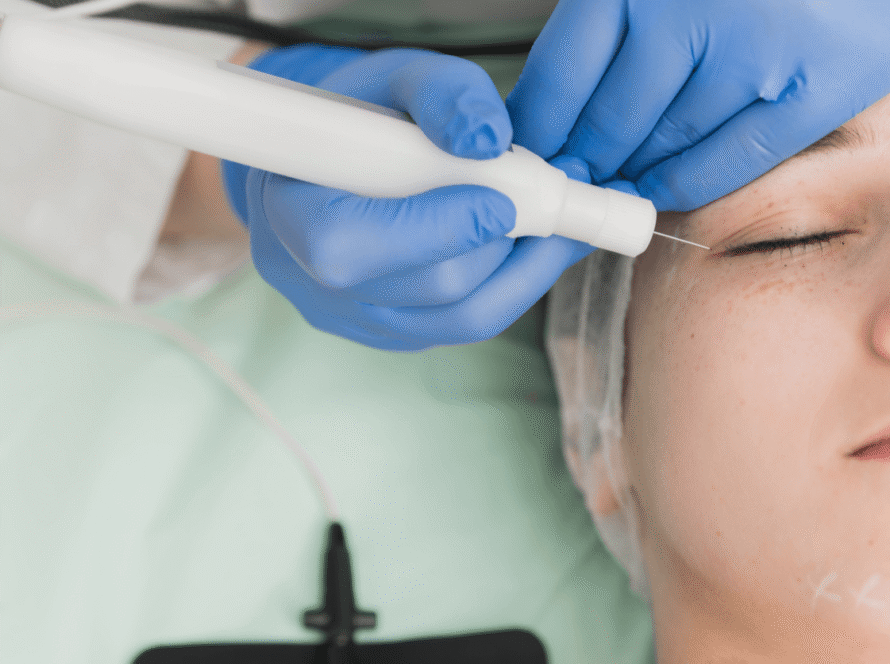 Plasma Pen Treatments: Safe Tightening for Eyes and Neck
