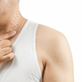 Why Choose a Medical Aesthetics Clinic For Skin Tag Removal