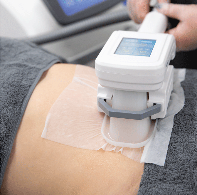 Body Contouring - Sculpting