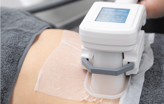 Body Contouring - Sculpting