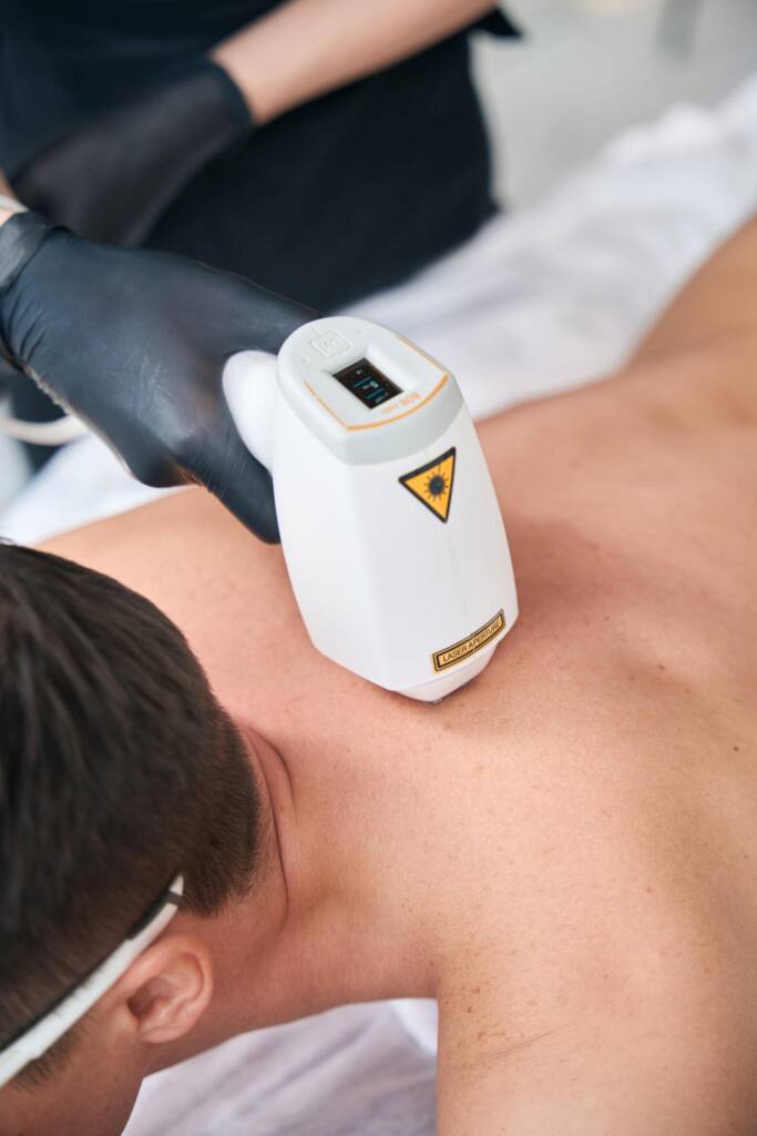 Male laser hair removal