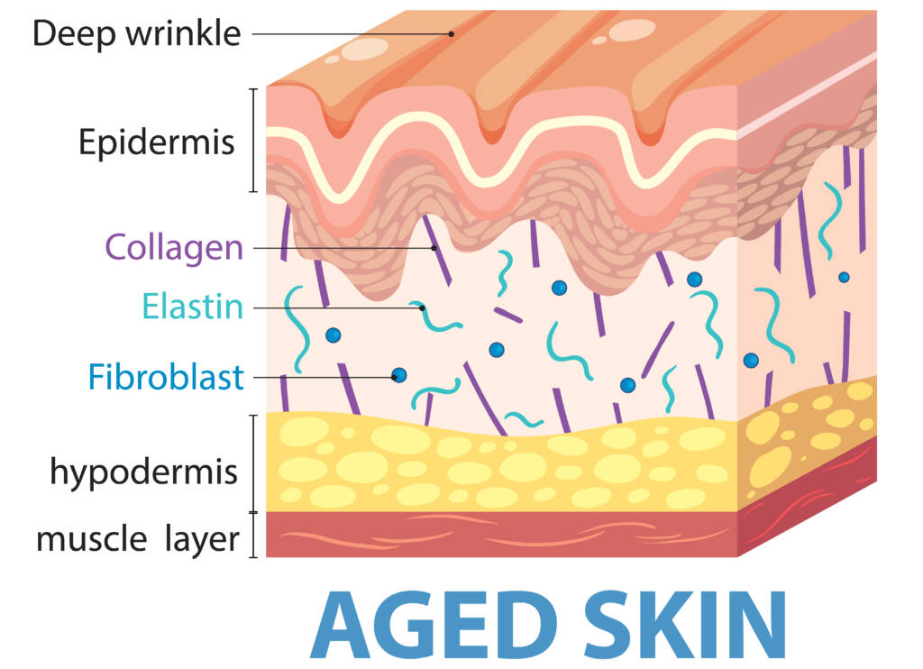 How facial ageing affects collagen and skin structure