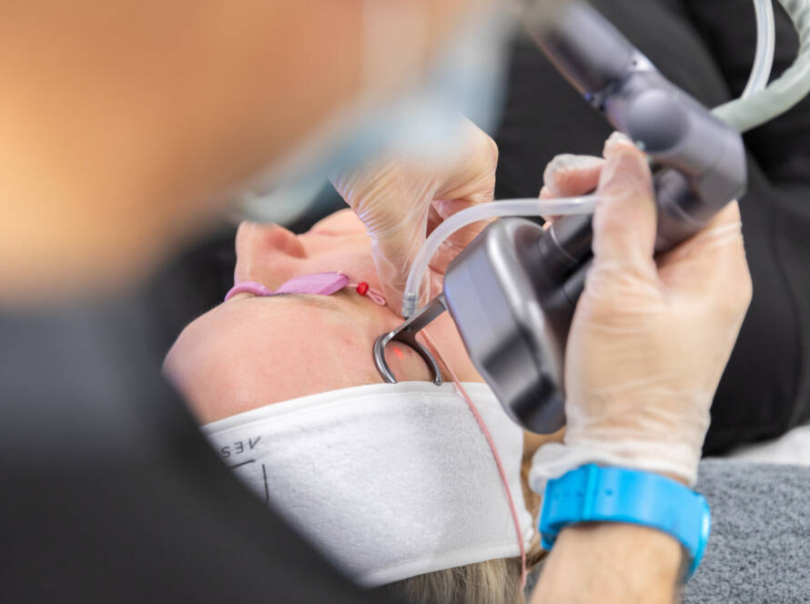 Hair thinning in women over 40 treatment in Egham Surrey
