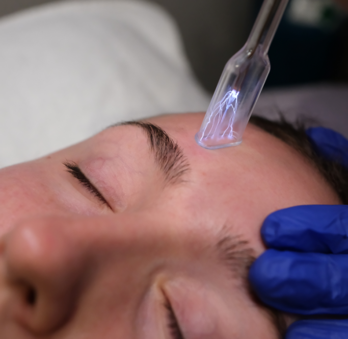 Plasma Fusion Treatment