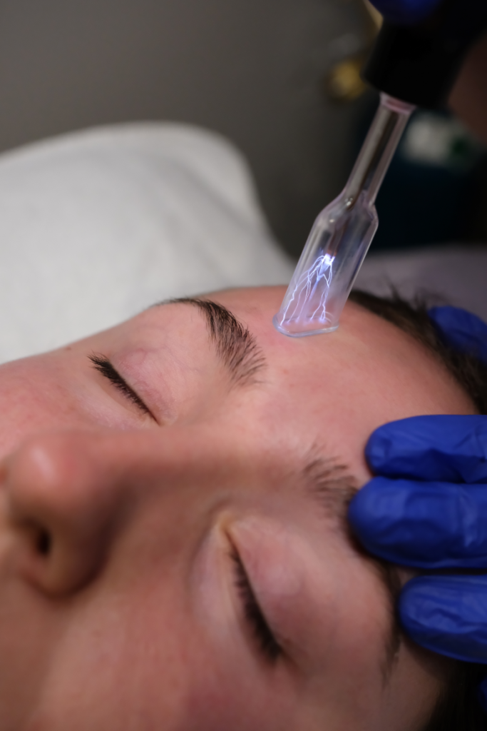 Plasma Skin Tightening & Skin Rejuvenation